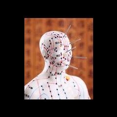 Beyond Proof with Angie Corbett-Kuiper: Re-defining Death and Loss: Acupuncture 101...What it is and how it works.